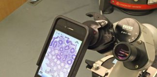 smartphone microscope